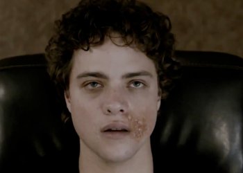 Antiviral: El Fandom En La Piel