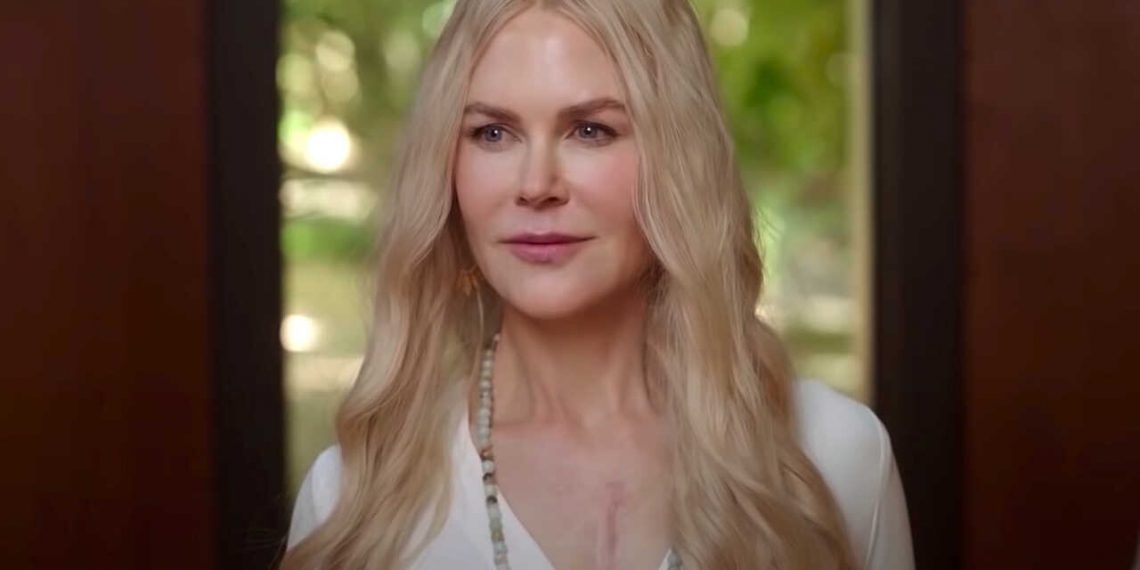 Una estrella de Nine Perfect Strangers tenía miedo de trabajar con Nicole Kidman